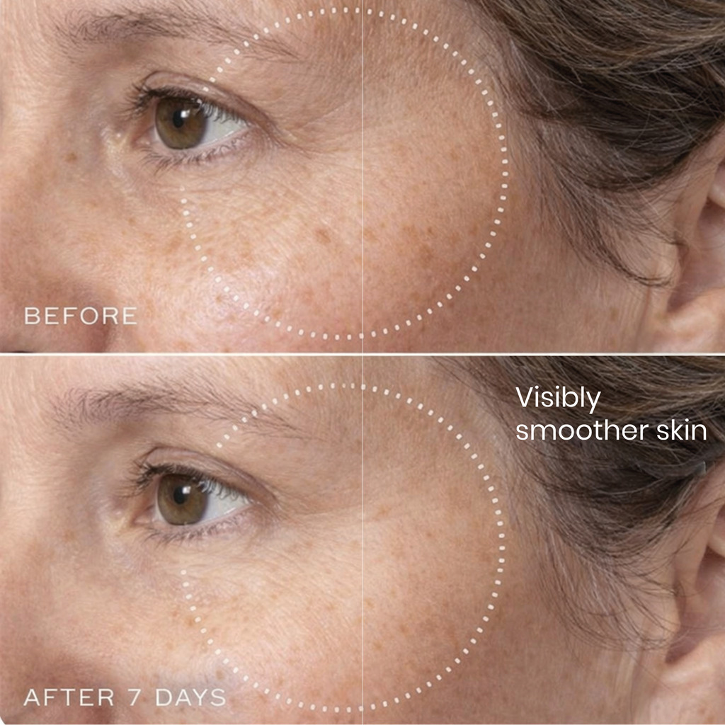 Brightr® Eye wrinkle smoothing patches